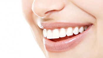 5 dicas para cuidar dos dentes no fim do ano